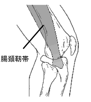 腸脛靱帯炎　【 ちょうけいじんたいえん 】